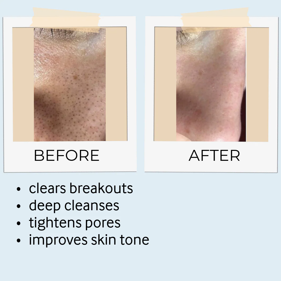 Rhassoul Mask & Scrub - Image 8