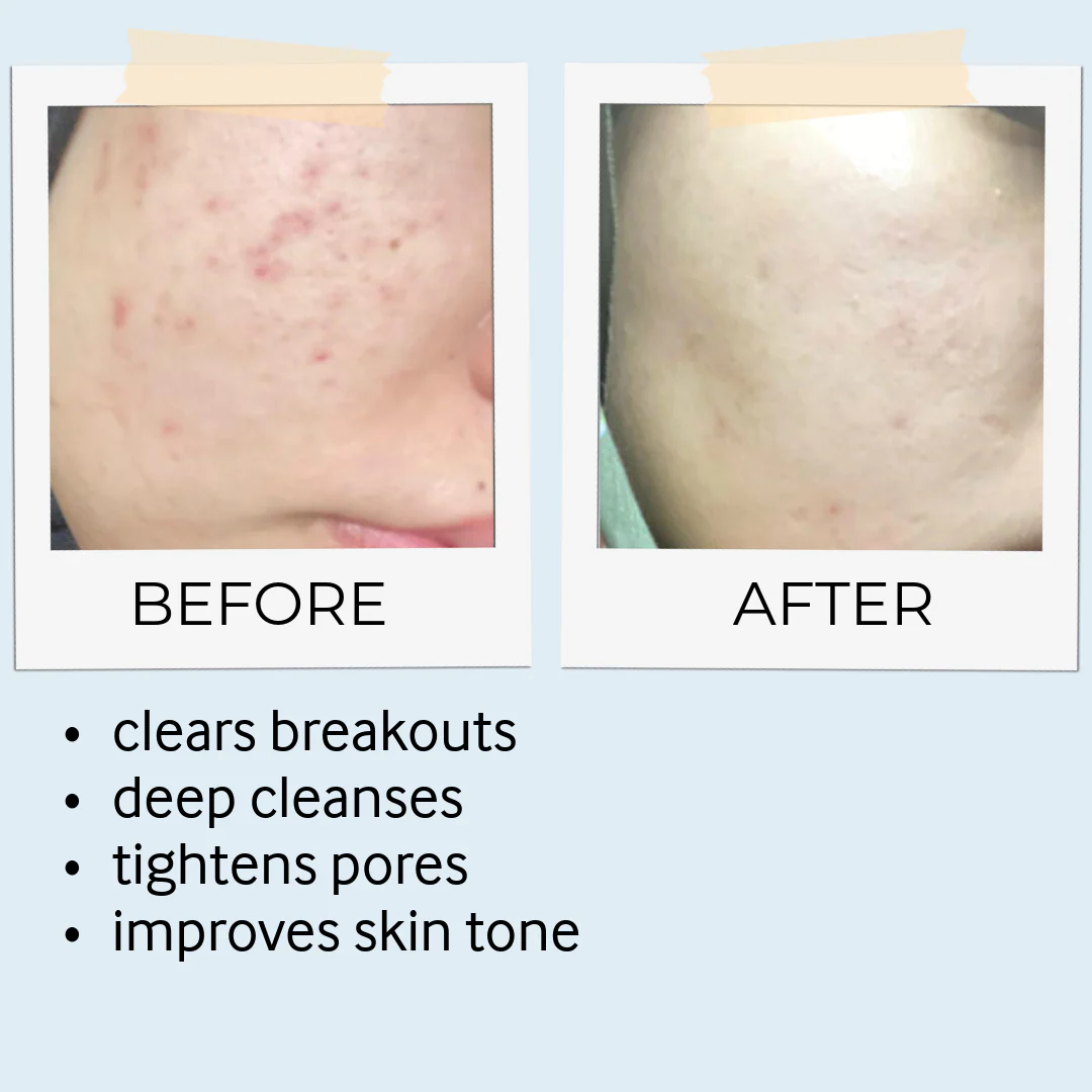 Rhassoul Mask & Scrub - Image 12