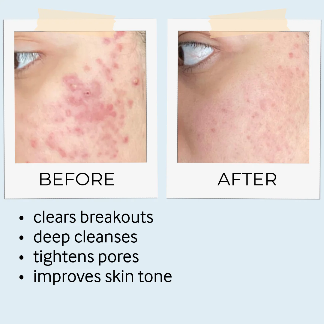 Rhassoul Mask & Scrub - Image 13