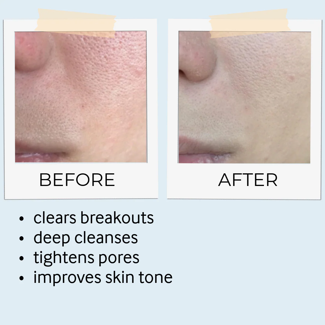 Rhassoul Mask & Scrub - Image 10