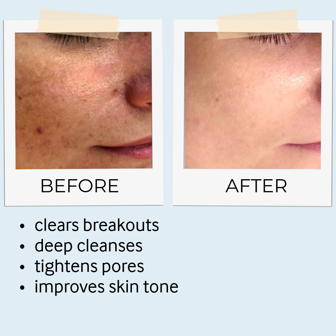 Rhassoul Mask & Scrub - Image 7